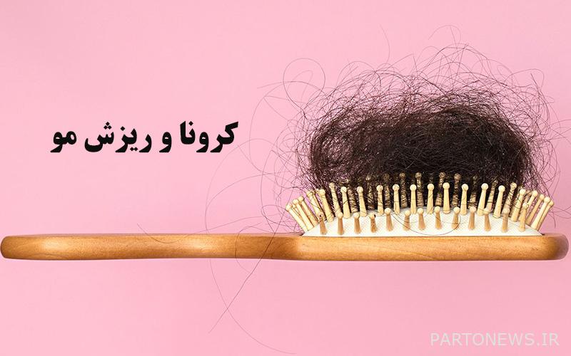 تساقط شعر