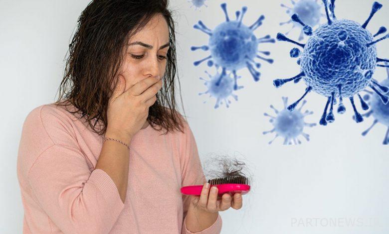 ما هي أفضل طريقة لعلاج تساقط الشعر التاجي؟