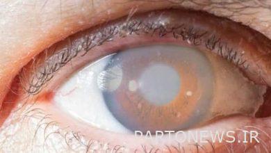 Recognize the most common eye diseases