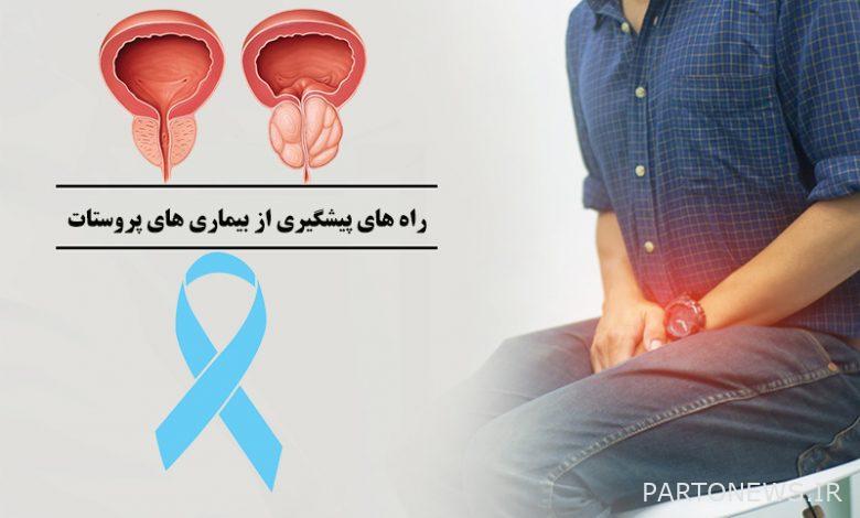 What are the ways to prevent and treat prostate?