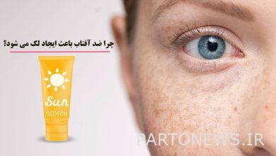 چرا ضد آفتاب باعث ایجاد لک می شود ؟ (تاثیر ضد آفتاب در ایجاد لک)