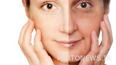 جوانسازی پوست با کربوکسی تراپی و مزوتراپی