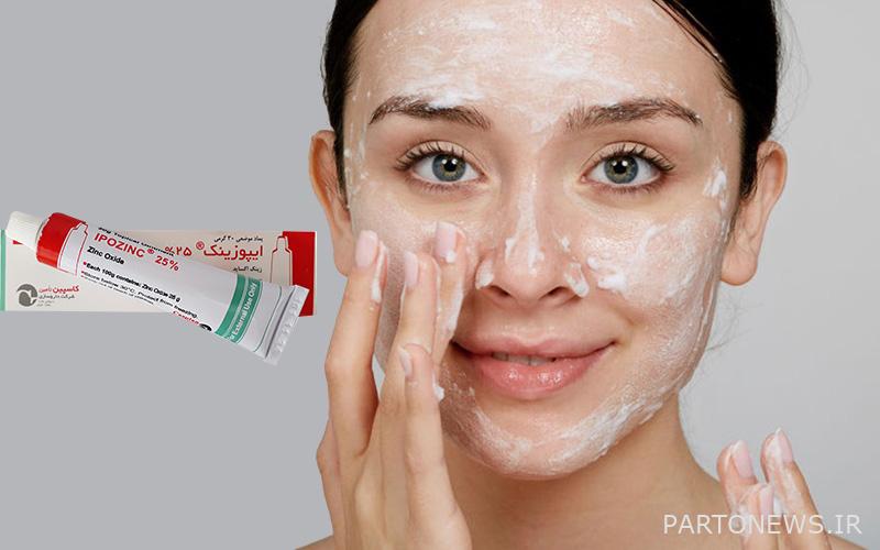 پماد زینک برای آکنه