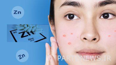 معجزه قرص زینک برای جوش صورت
