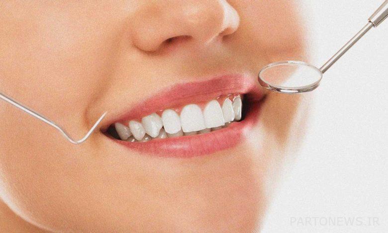 The best dental composite brand (introduction of 6 brands)