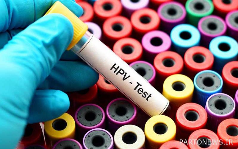HPV test