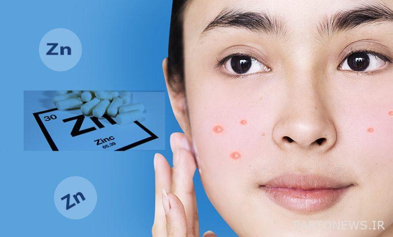 Miracle Zinc Pills for Acne