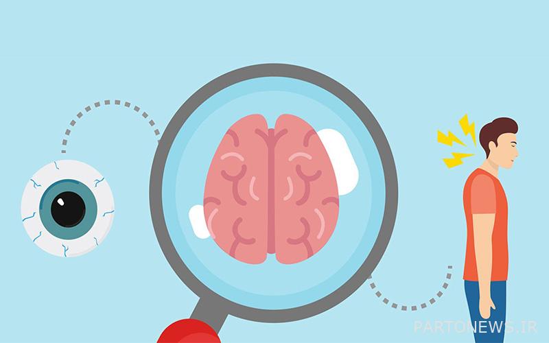 علائم ام اس