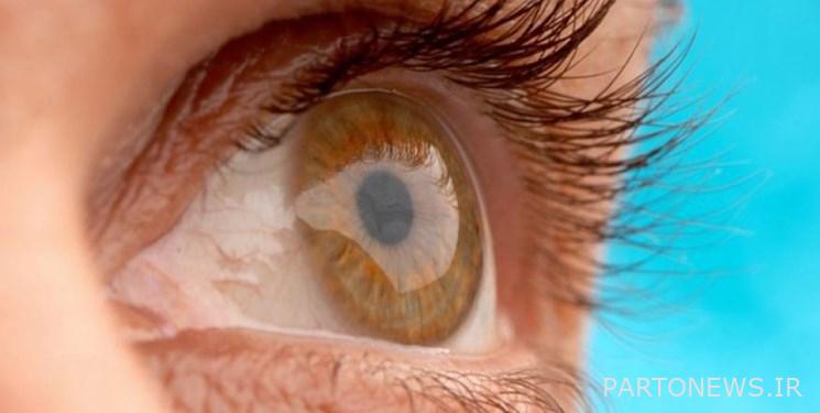 The most common "eye" diseases of young people