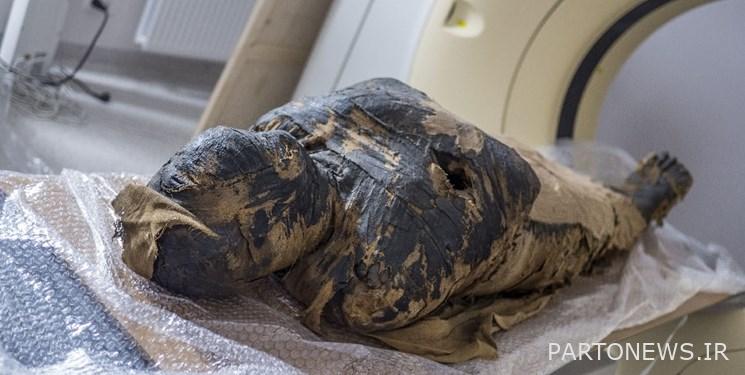 Revealing the secret of the royal mummy with medical imaging technique + images