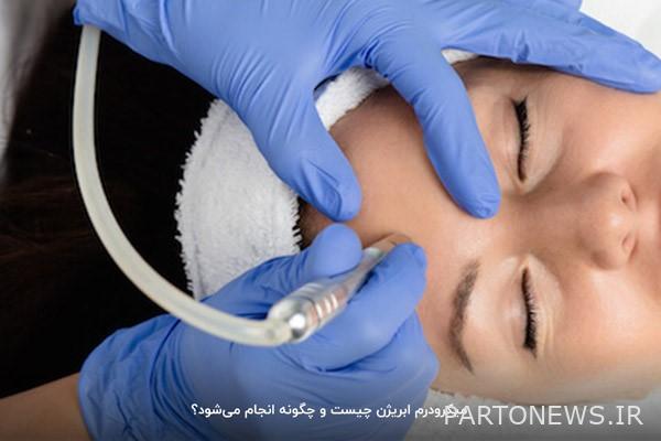 Microdermabrasion is the fastest and most effective way to treat skin problems