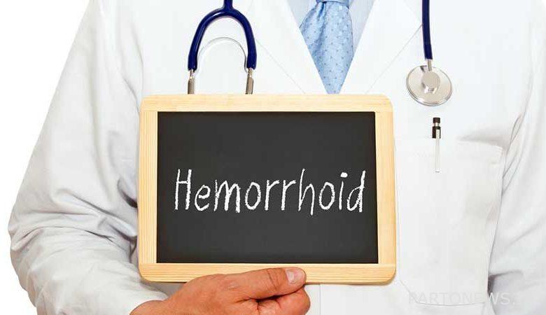 Treat hemorrhoids by choosing the right doctor!