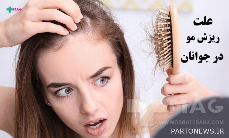 What is the cause of hair loss in young people and how is it treated?