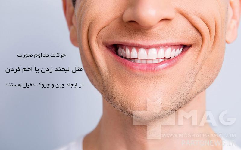 The effect of facial movements on wrinkles