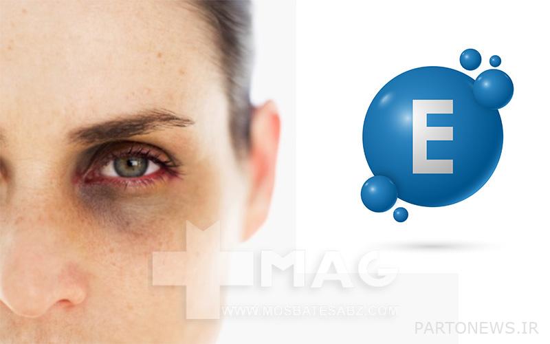 Vitamin E for dark circles around the eyes