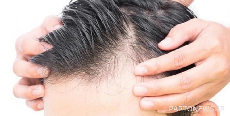 Get to know natural hair enhancers!
