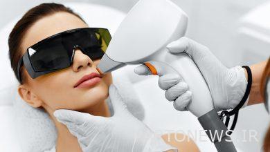 10 Common Questions Before Laser Hair Removal