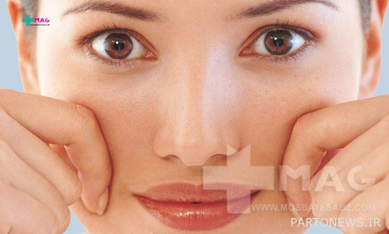 Does collagen cause facial obesity?