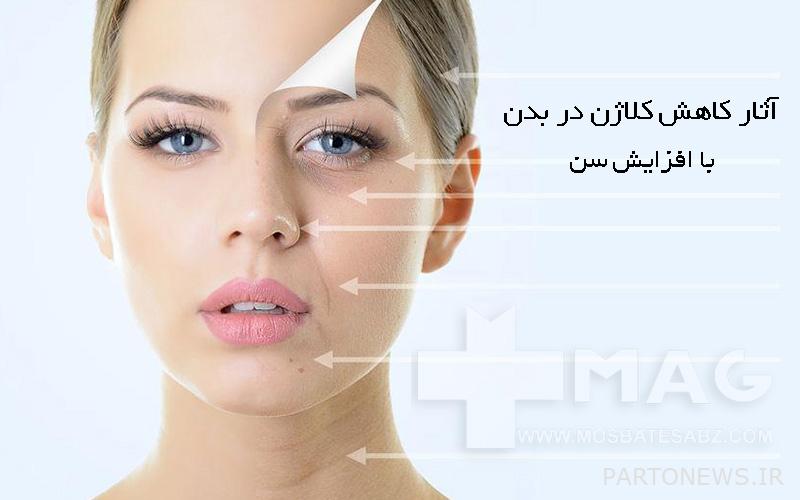 Effects of collagen reduction on the skin