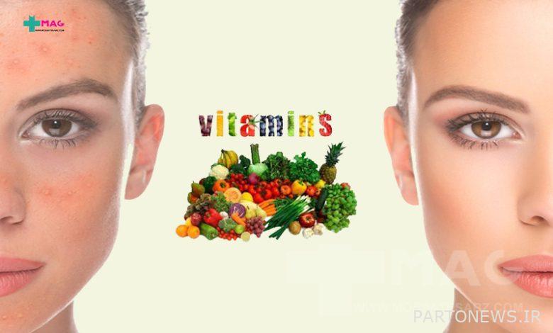 Which skin problems are caused by vitamin deficiency?