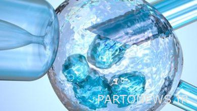 علاج التهاب المفاصل بالخلايا الجذعية / حقن الخلايا الجذعية في الحبل السري للأطفال المصابين بالشلل الدماغي