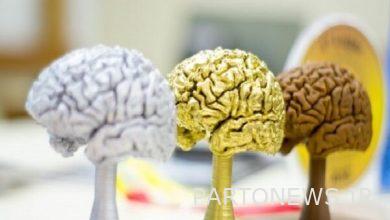 Holding the first summer school of brain science - Mehr News Agency |  Iran and world's news