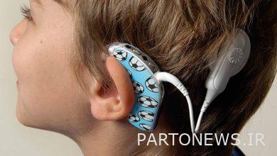 Cochlear implantation and hearing aid installation are observed