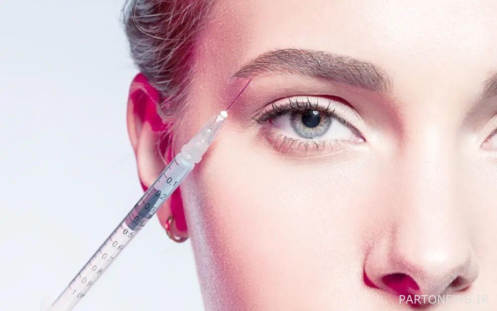 Eyebrow lift with thread advantages, complications and its process