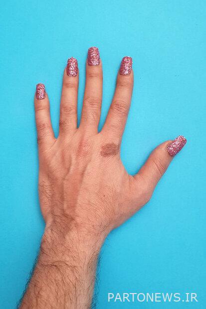 قالوا إنك حصلت على نقود لجعل المصلي أصلع / لقد لعنت من الجانبين!