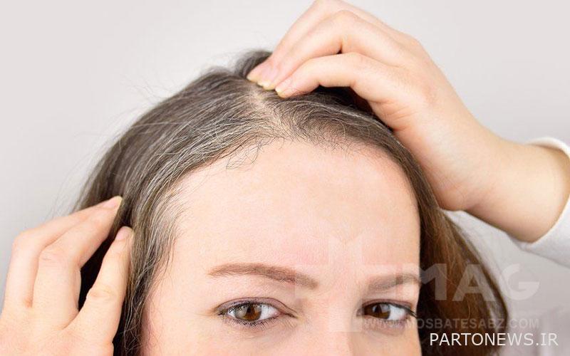 The effect of stress on hair