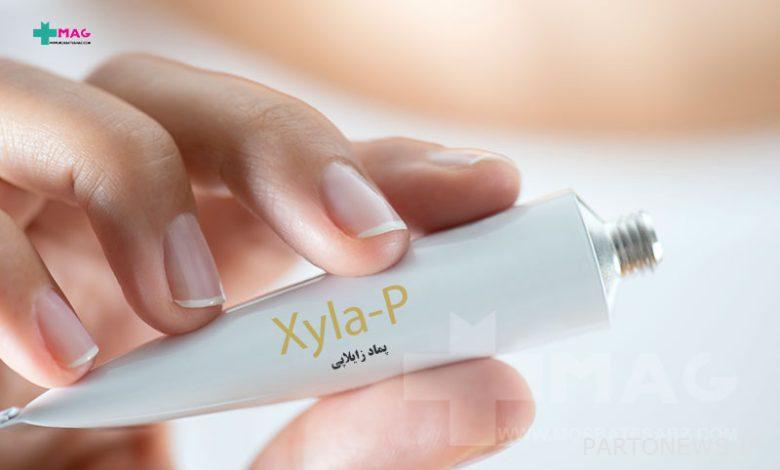 Xylapi ointment for early ejaculation and wedding night