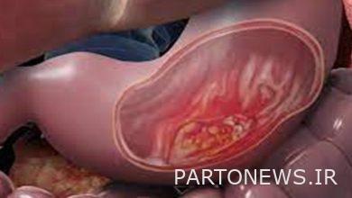 A dangerous sign in the body of women