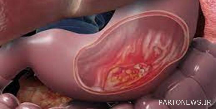 A dangerous sign in the body of women
