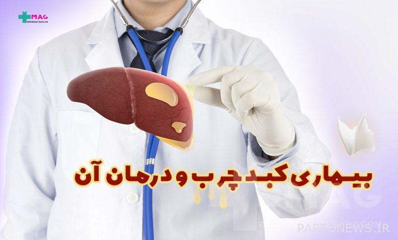 What are the causes of fatty liver disease and its treatment methods?