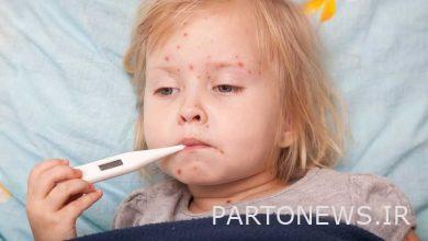 واکسیناسیون جهانی متاثر از شیوع کرونا/ده‌ها میلیون کودک در خطر ابتلا به سرخک هستند