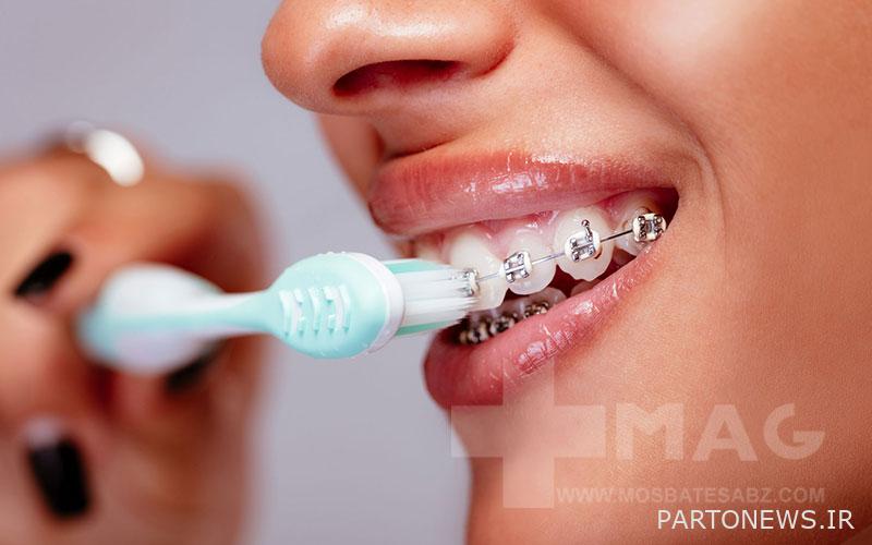 Orthodontic toothbrush
