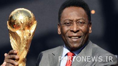 فقد الأطباء الأمل في "بيليه" / أسطورة كرة القدم لم يستجب للعلاج الكيميائي