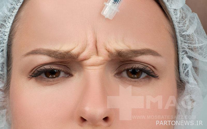 Botox