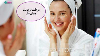 Daily acne skin care routine