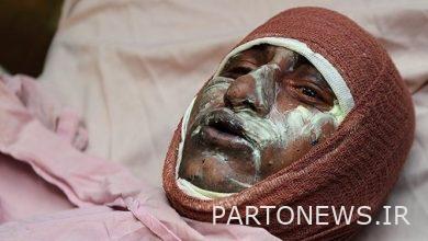 تعرف على أخطر إصابة بالجسم!