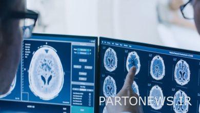 Identification of 93 new patients of Covid-19 in the country/one more patient died