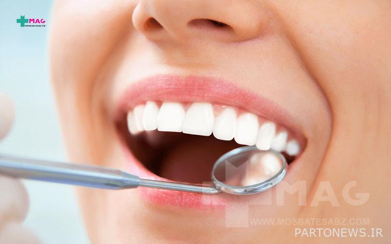 5 Of The Best Ways To Strengthen Tooth Enamel - پرتو نیوز