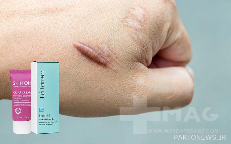 Repair cream for stitches