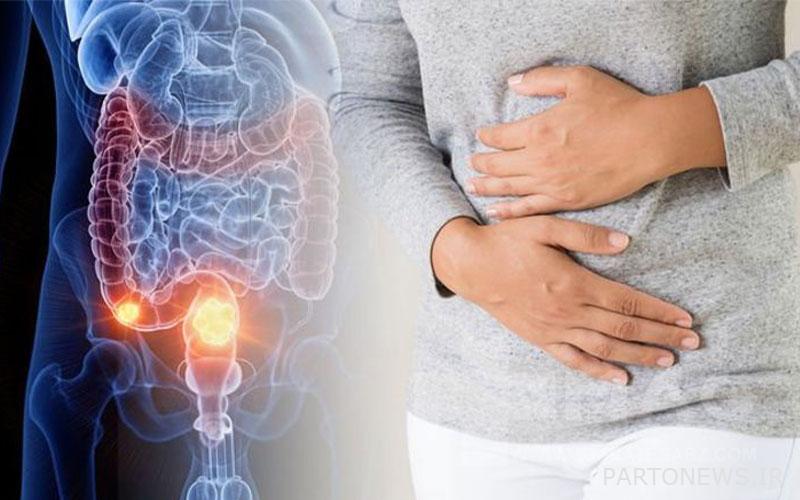 Stomach problems