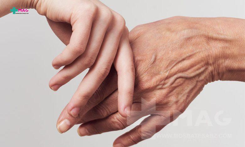 What is the cause of hand wrinkles? 10 of the best ways to get rid of it