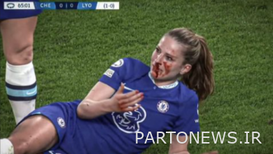 ملانی لوپولز با ریختن خون از چهره ستاره چلسی در قهرمانی لیگ قهرمانان، طرف خنده‌داری را می‌بیند.