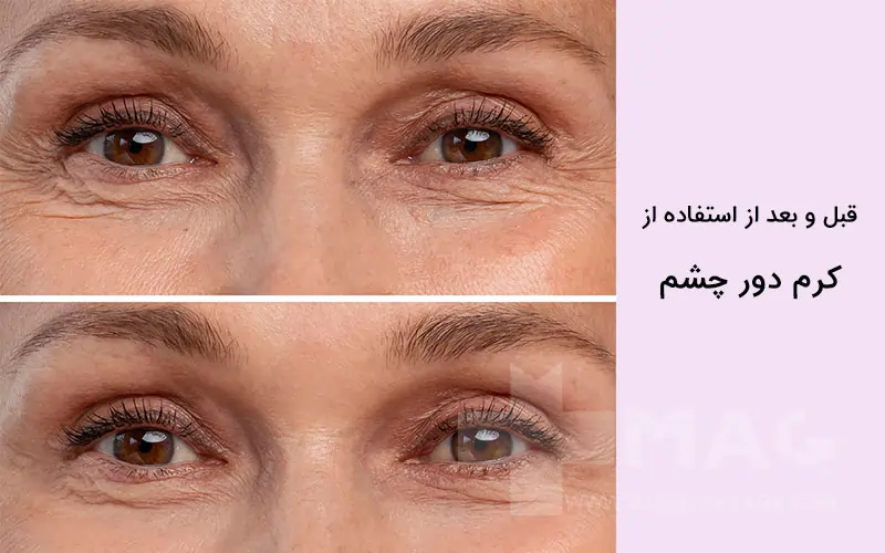 Benefits of eye cream