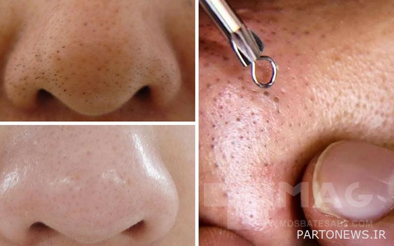 Facial cleansing at home