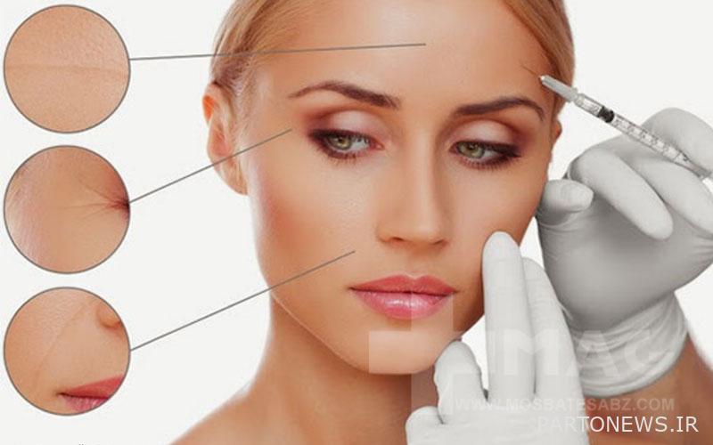The effect of mesotherapy