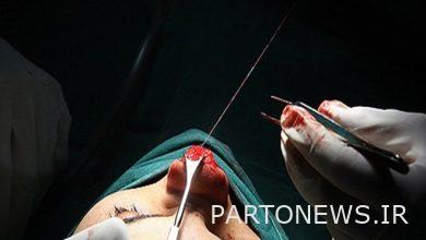 Many non-specialists call themselves cosmetic surgeons